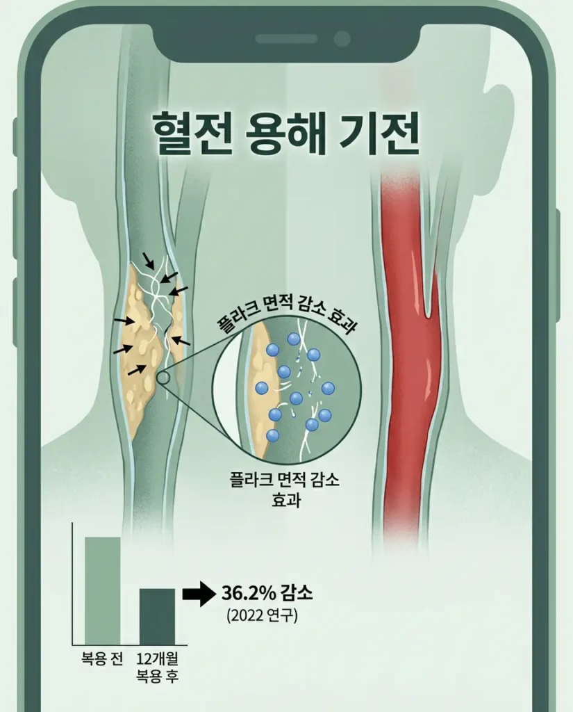 나토키나아제 영양제가 혈전(피브린)을 직접 용해하고 혈관 플라크를 줄이는 과학적 기전을 보여주는 의료 일러스트입니다.